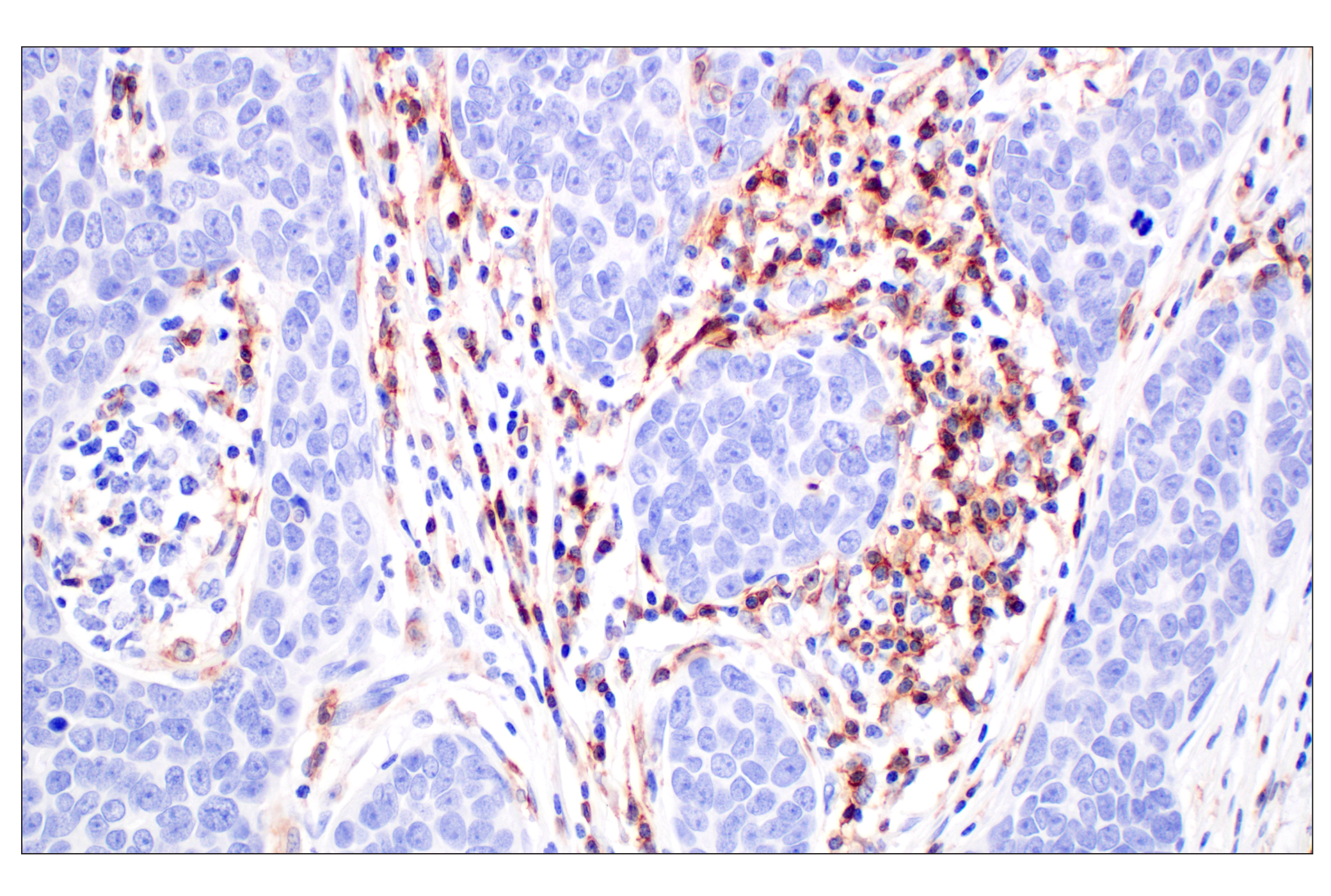 Immunohistochemistry Image 2: CD4 (MSVA-004R) Rabbit mAb (BSA and Azide Free)