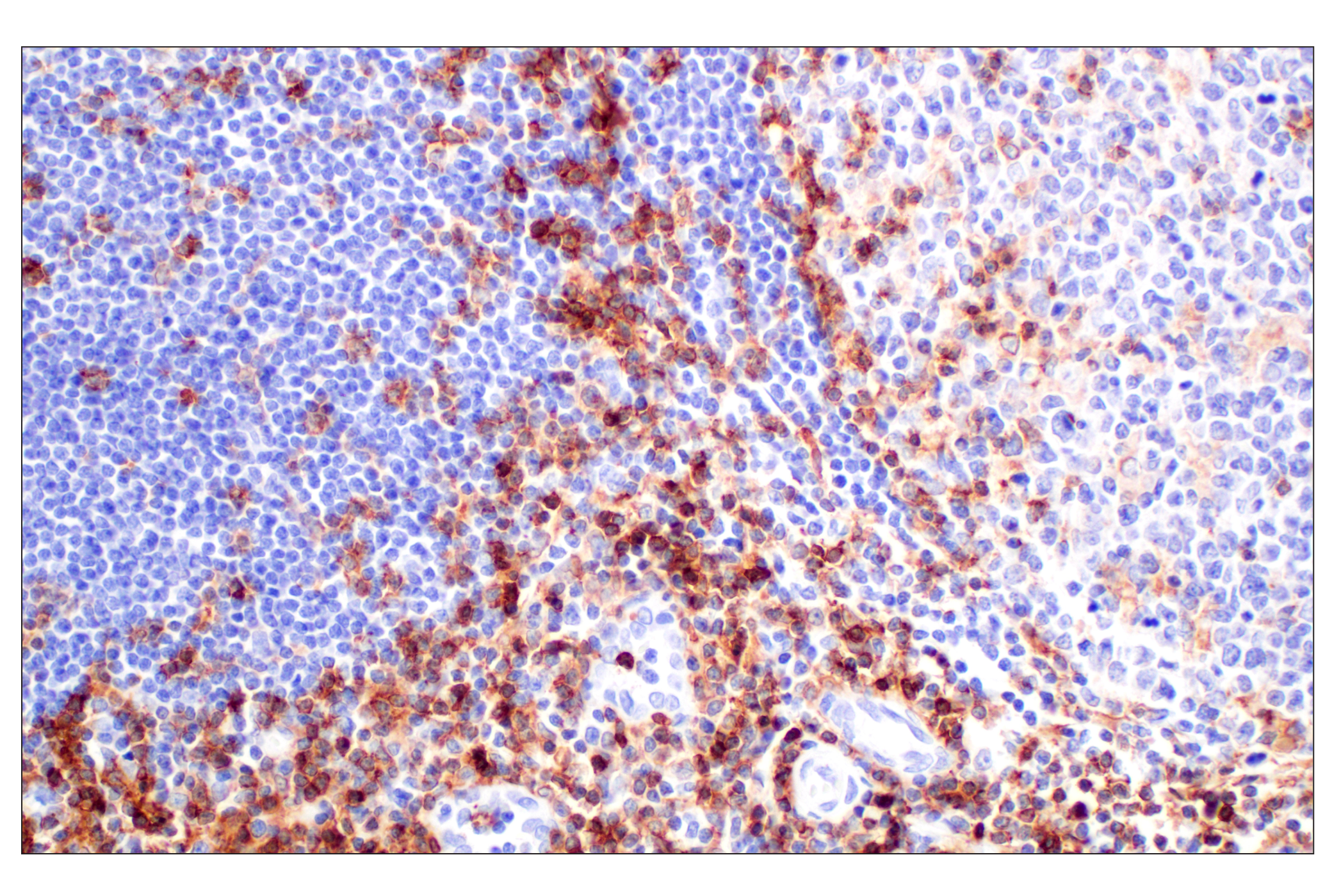 Immunohistochemistry Image 5: CD4 (MSVA-004R) Rabbit mAb (BSA and Azide Free)