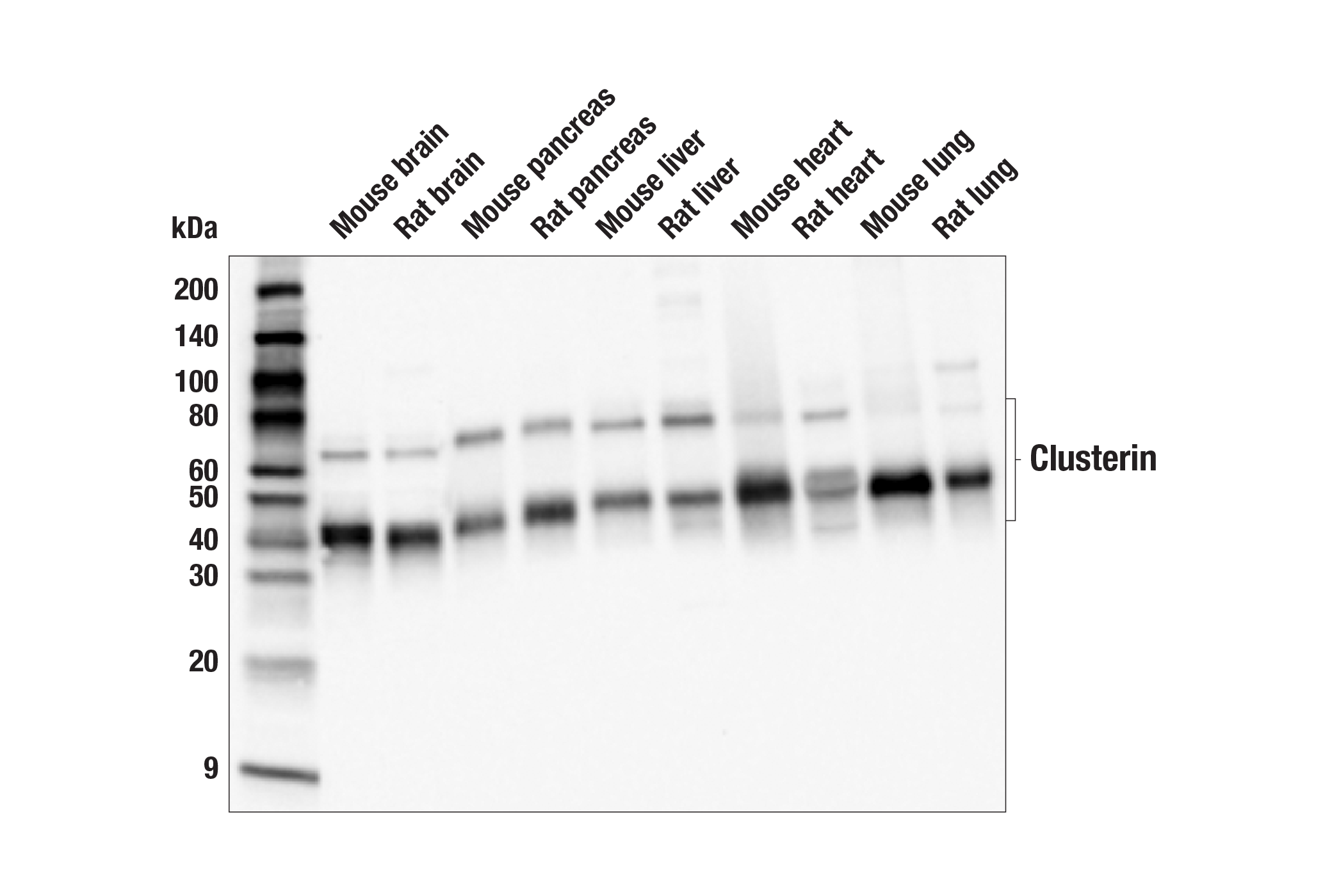 Western Blotting Image 2: Clusterin (E2O1D) Rabbit mAb