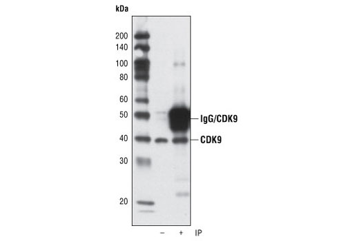 Immunoprecipitation Image 1: CDK9 (C12F7) Rabbit mAb