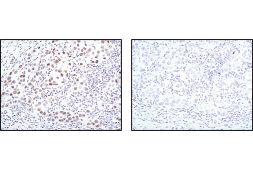 Immunohistochemistry Image 1: CDK9 (C12F7) Rabbit mAb