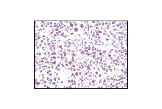 Immunohistochemistry Image 2: CDK9 (C12F7) Rabbit mAb