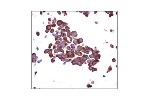 Immunohistochemistry Image 3: S6 Ribosomal Protein (54D2) Mouse mAb