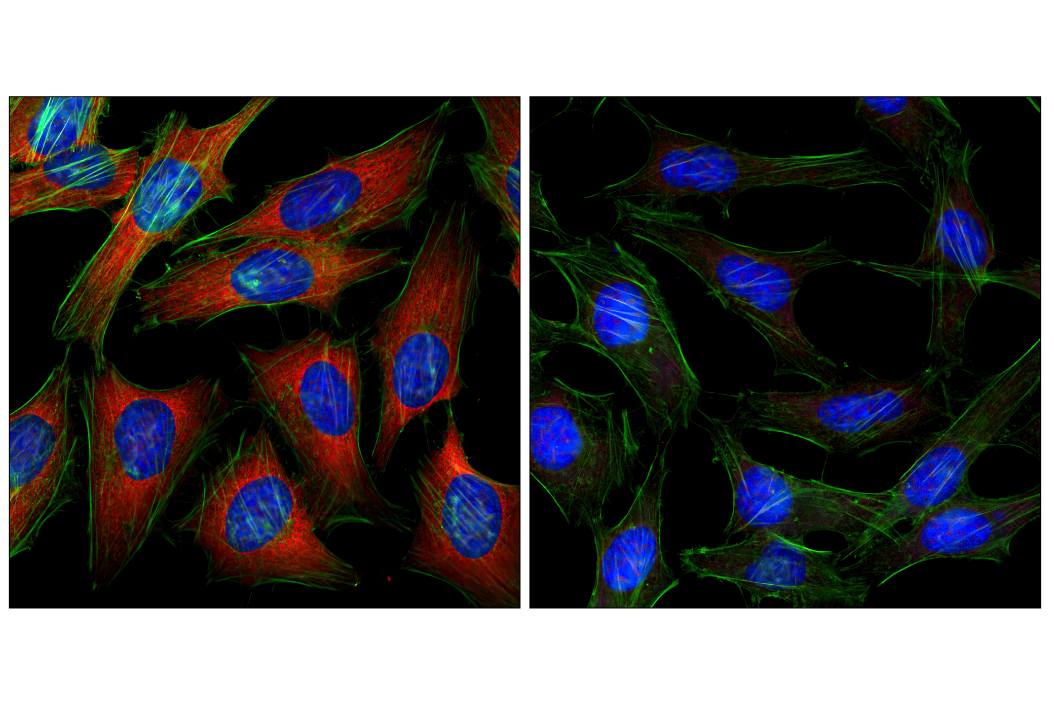Immunofluorescence Image 1: S6 Ribosomal Protein (54D2) Mouse mAb