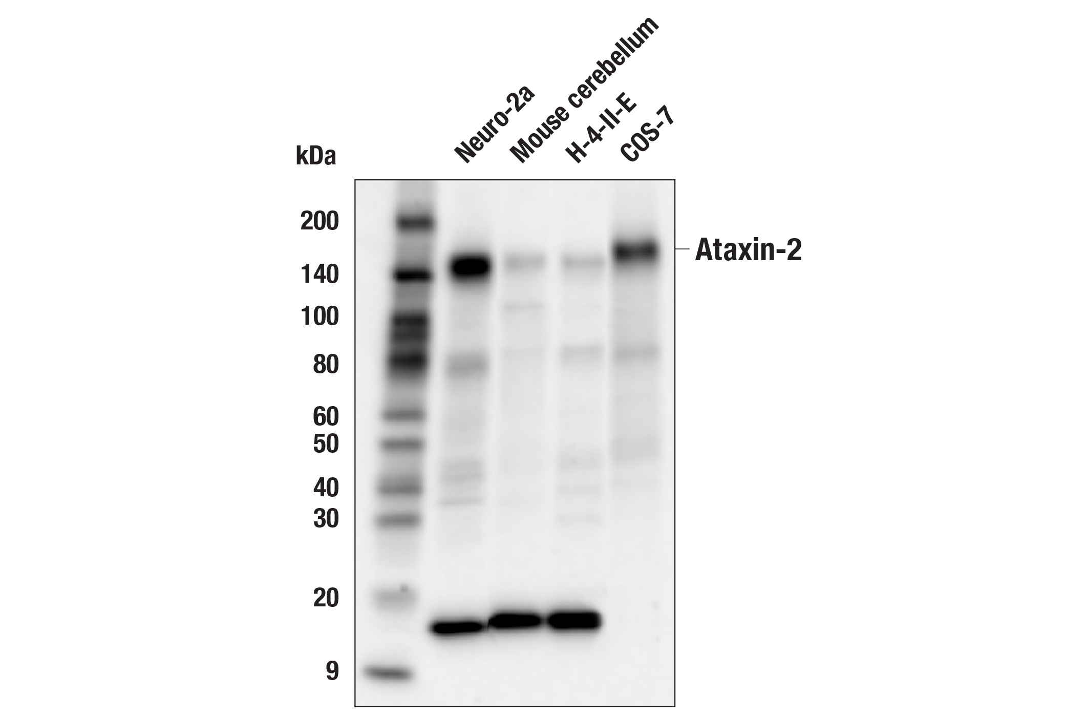 Western Blotting Image 2: Ataxin-2 (E3B3Z) Rabbit Monoclonal Antibody (BSA and Azide Free)