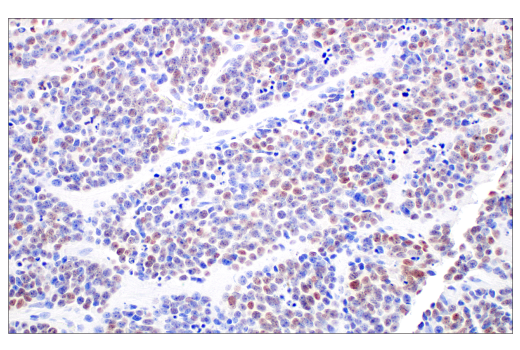 Immunohistochemistry Image 5: Thyroid Transcription Factor 1 (TTF-1) (SPT24) Mouse mAb