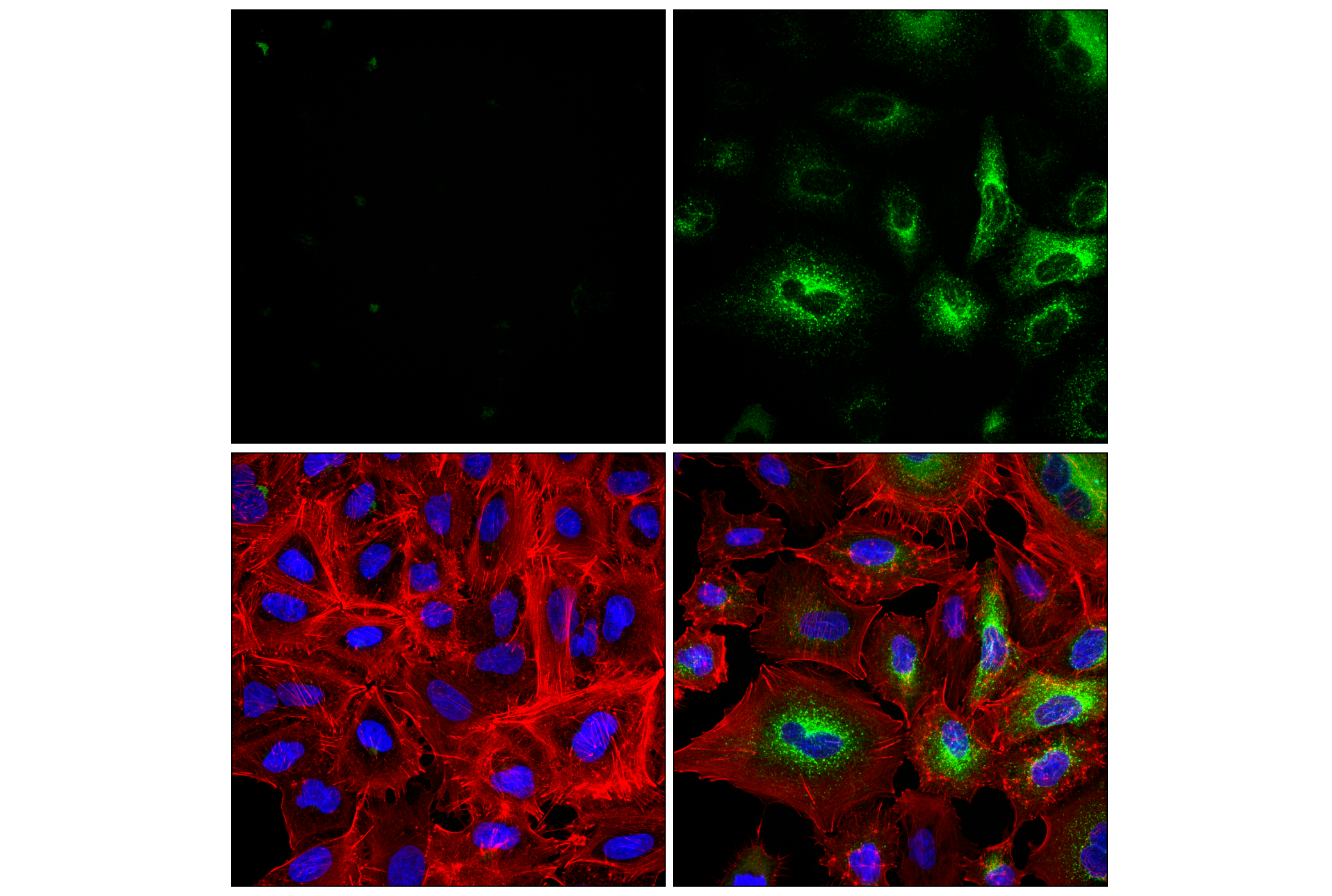 Immunofluorescence Image 1: MCP-1 (F9I9N) Rabbit mAb