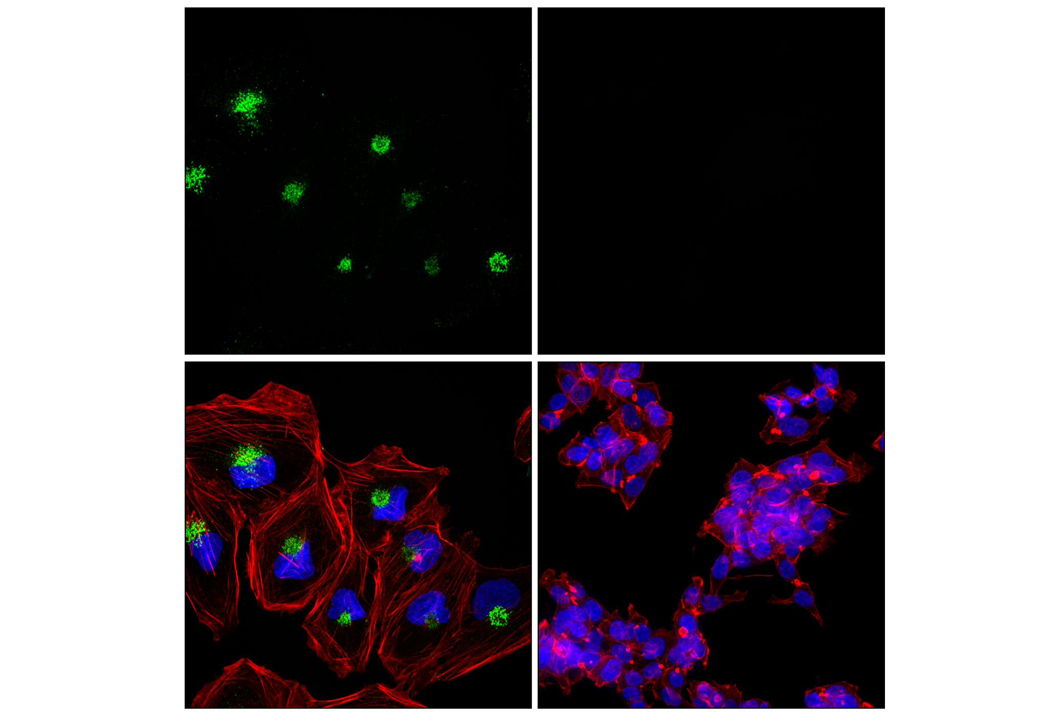 Immunofluorescence Image 2: MCP-1 (F9I9N) Rabbit mAb