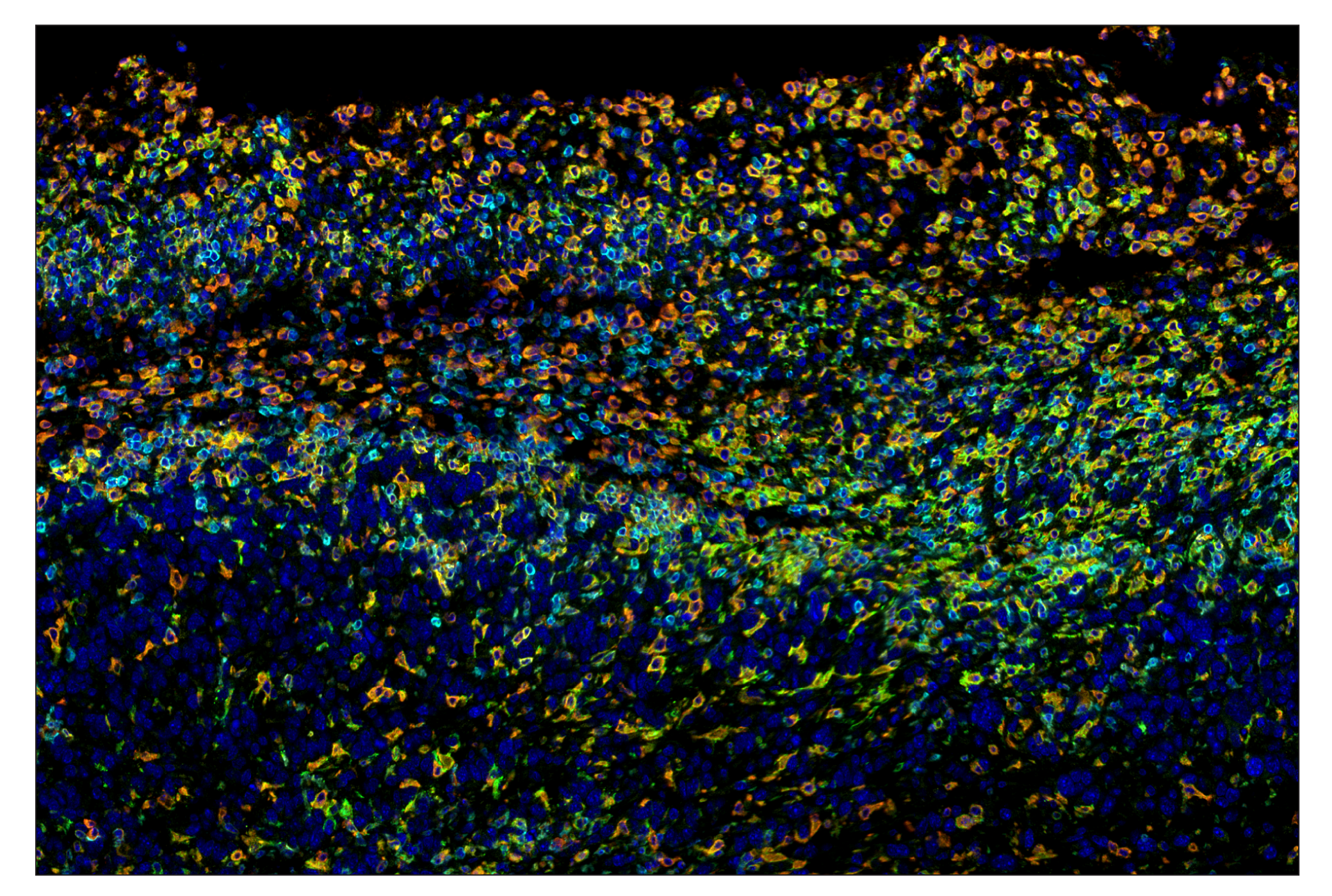 Immunohistochemistry Image 7: CD86 (E5W6H) & CO-0051-647 SignalStar™ Oligo-Antibody Pair