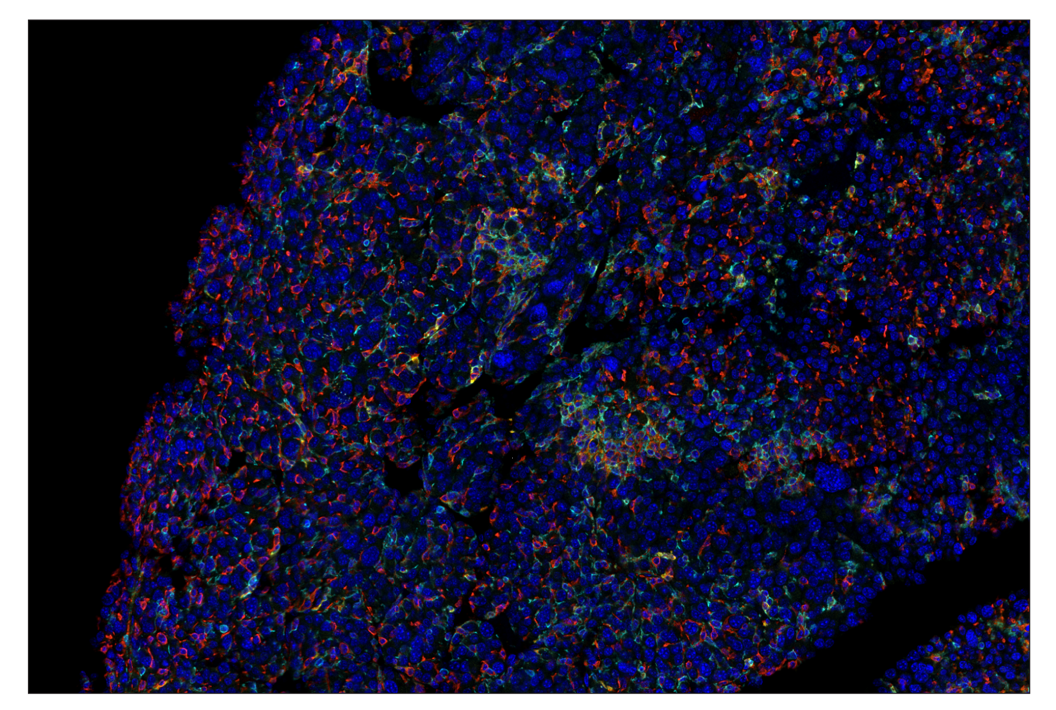 Immunohistochemistry Image 8: CD86 (E5W6H) & CO-0051-488 SignalStar™ Oligo-Antibody Pair