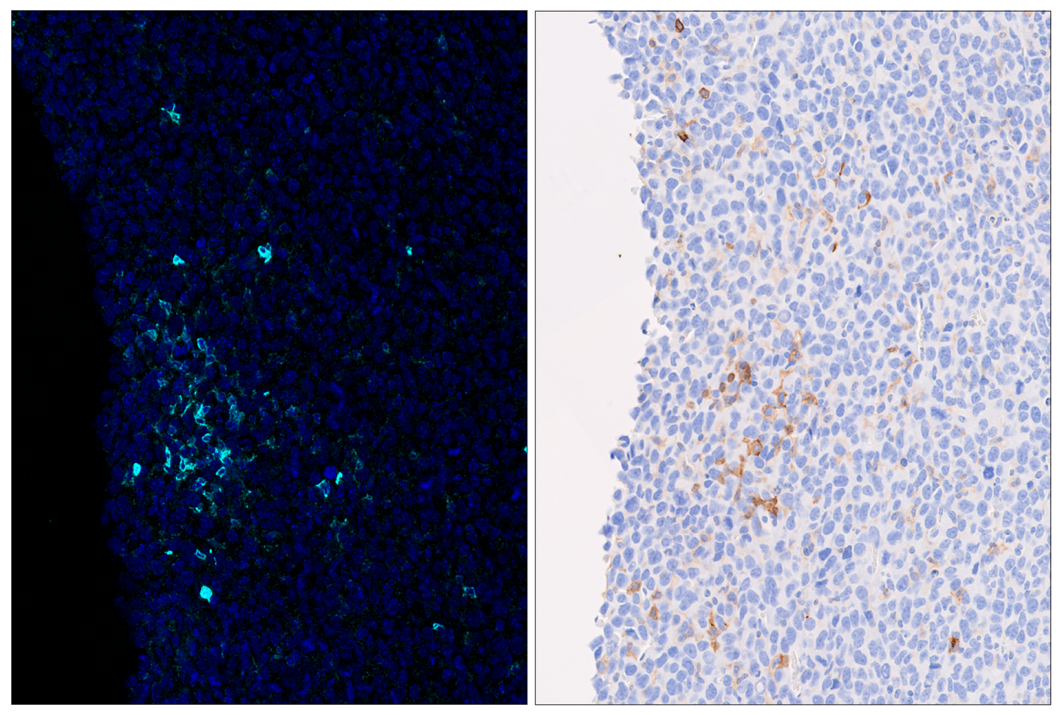 Immunohistochemistry Image 6: CD86 (E5W6H) & CO-0051-488 SignalStar™ Oligo-Antibody Pair