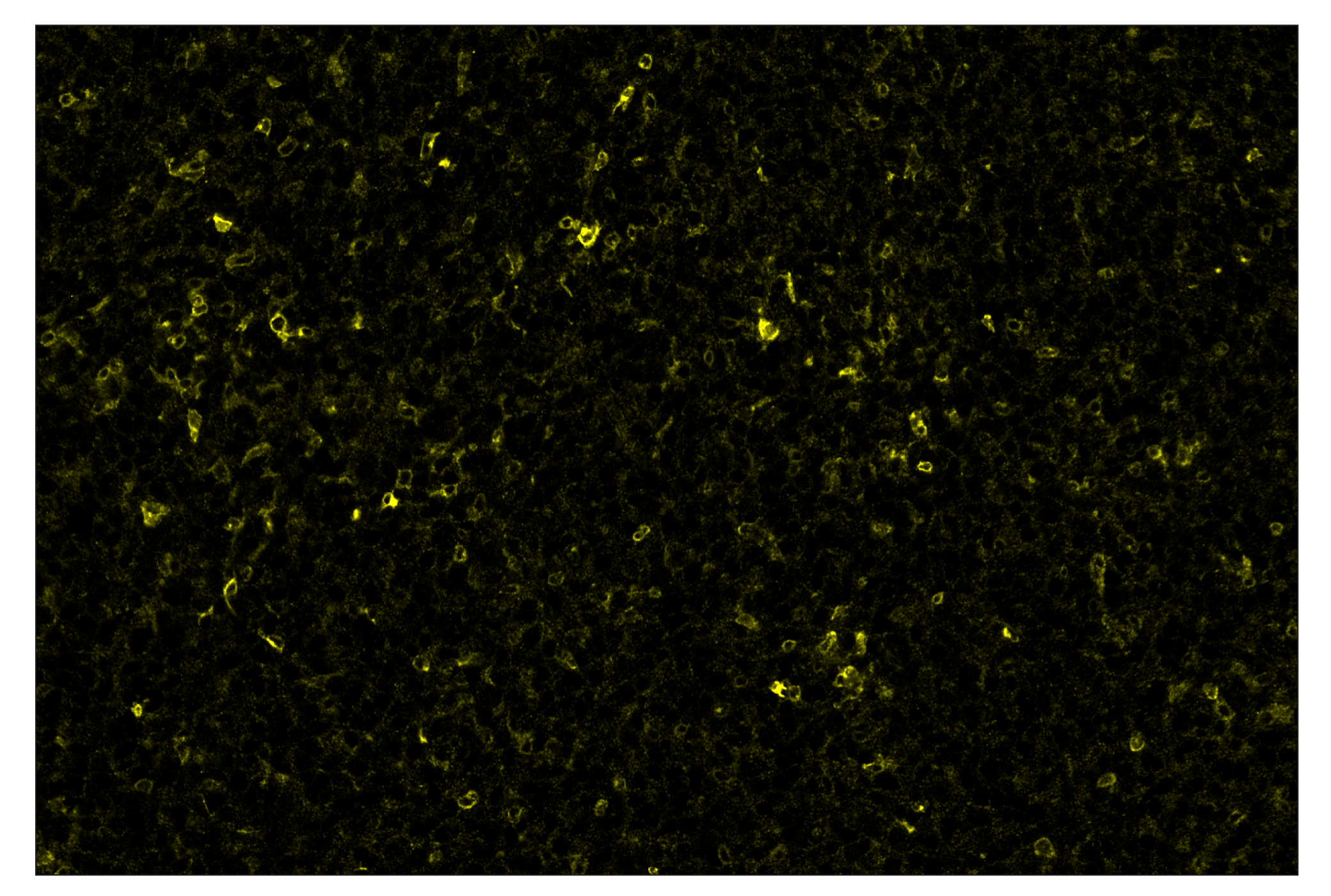 Immunohistochemistry Image 3: CD86 (E5W6H) & CO-0051-750 SignalStar™ Oligo-Antibody Pair