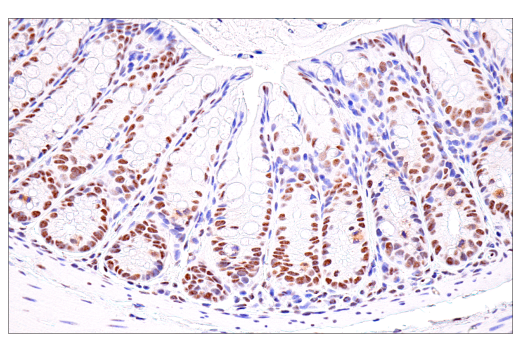 Immunohistochemistry Image 11: USP39 (E8U2M) Rabbit mAb
