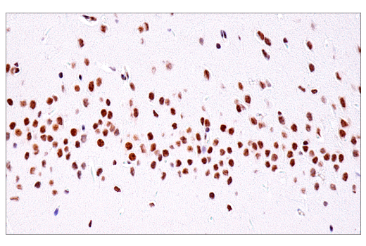 Immunohistochemistry Image 15: USP39 (E8U2M) Rabbit mAb