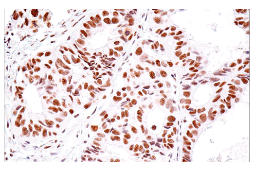 Immunohistochemistry Image 2: USP39 (E8U2M) Rabbit mAb