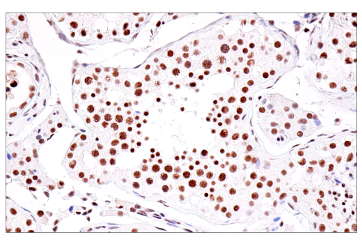 Immunohistochemistry Image 8: USP39 (E8U2M) Rabbit mAb
