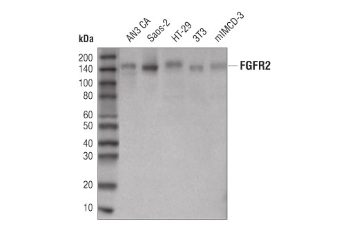 Western Blotting Image 1: FGF Receptor 2 (D4L2V) Rabbit mAb