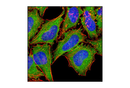 Immunofluorescence Image 1: eEF2 Antibody