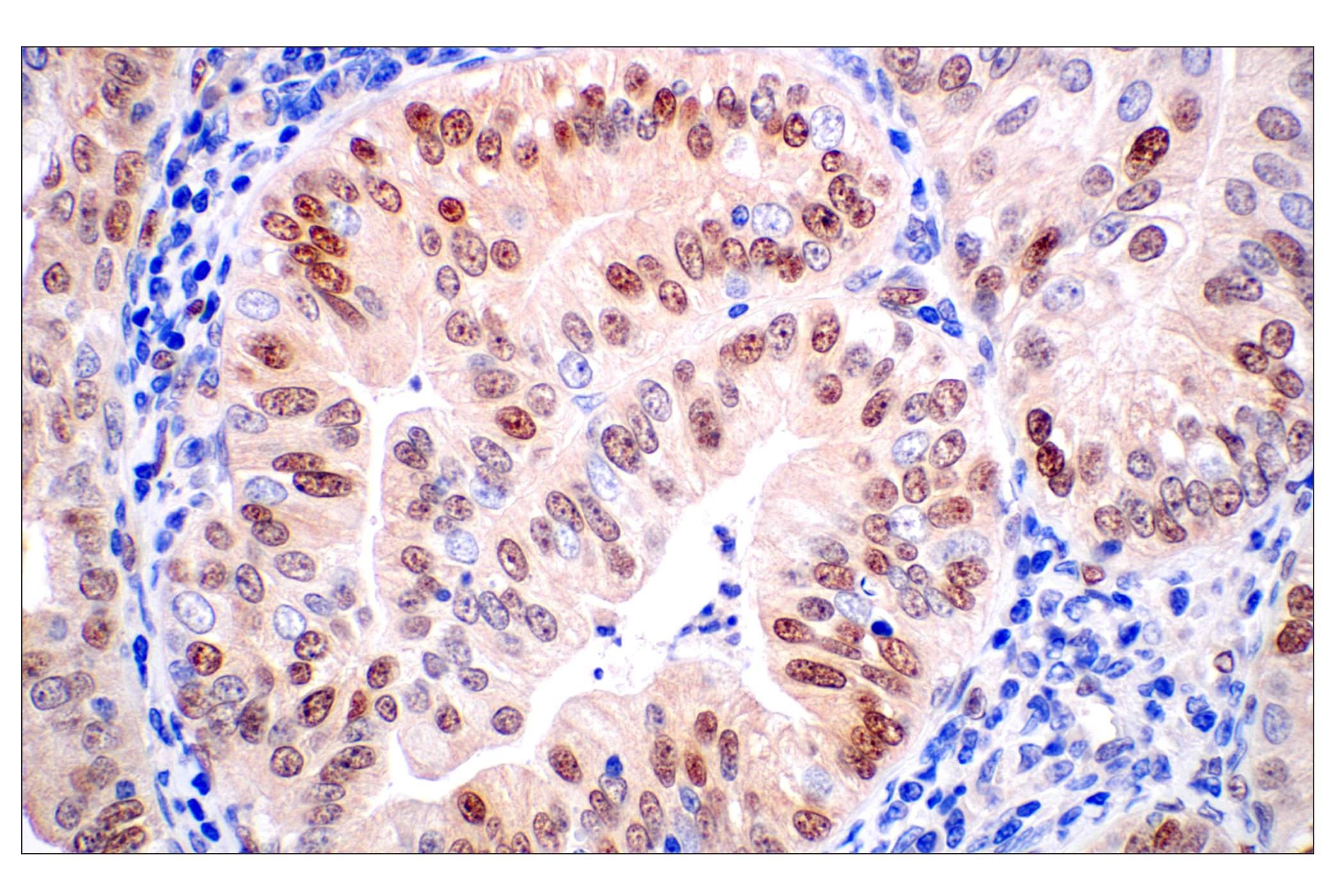 Immunohistochemistry Image 1: ID1 (F2M1J) Rabbit mAb