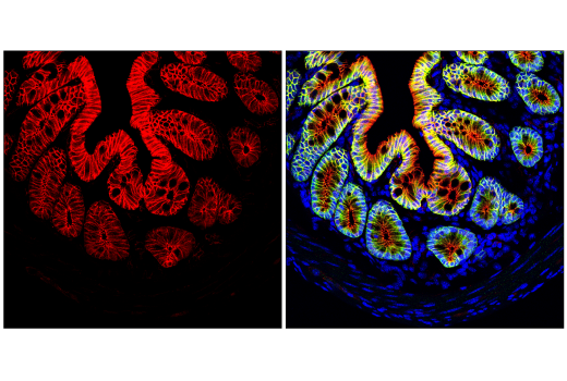 Immunofluorescence Image 1: β-Catenin (D10A8) XP® Rabbit mAb (Alexa Fluor® 647 Conjugate)