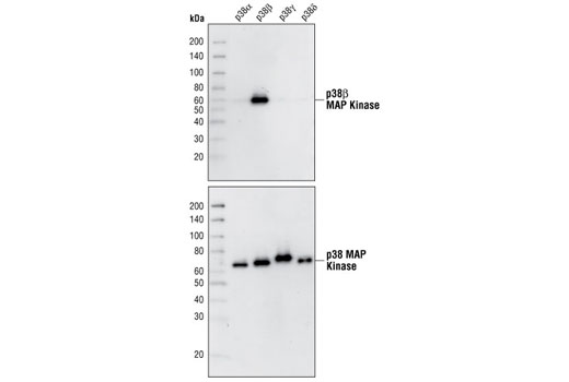  Image 3: p38 MAPK Isoform Activation Antibody Sampler Kit