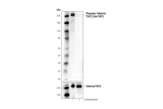 Western Blotting Image 1: Phospho-Tuberin/TSC2 (Ser1387) (D2R3A) Rabbit mAb