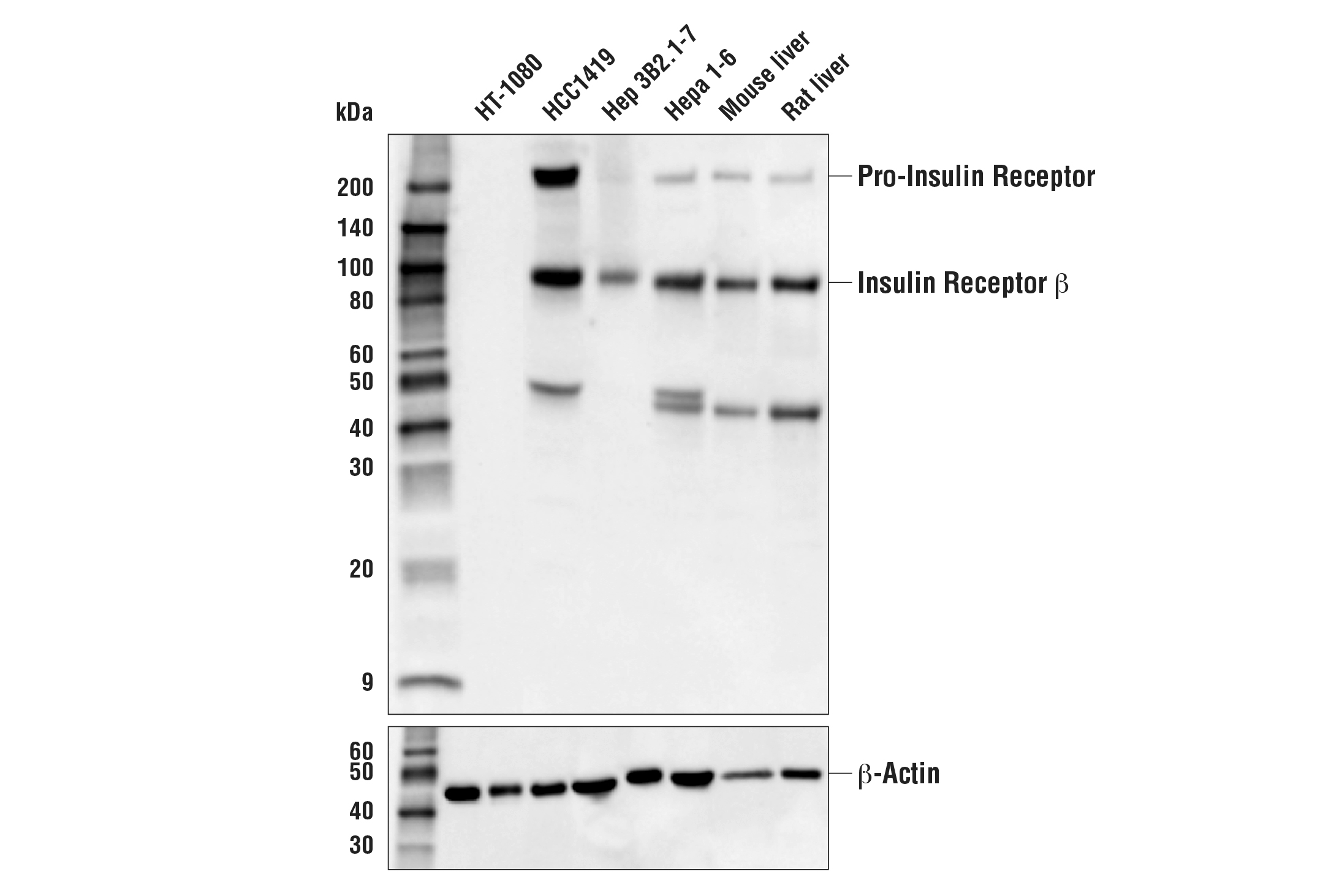 Western Blotting Image 1: Insulin Receptor β (E9L5V) XP® Rabbit mAb