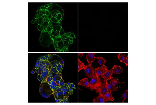Immunofluorescence Image 2: Insulin Receptor β (E9L5V) XP® Rabbit mAb