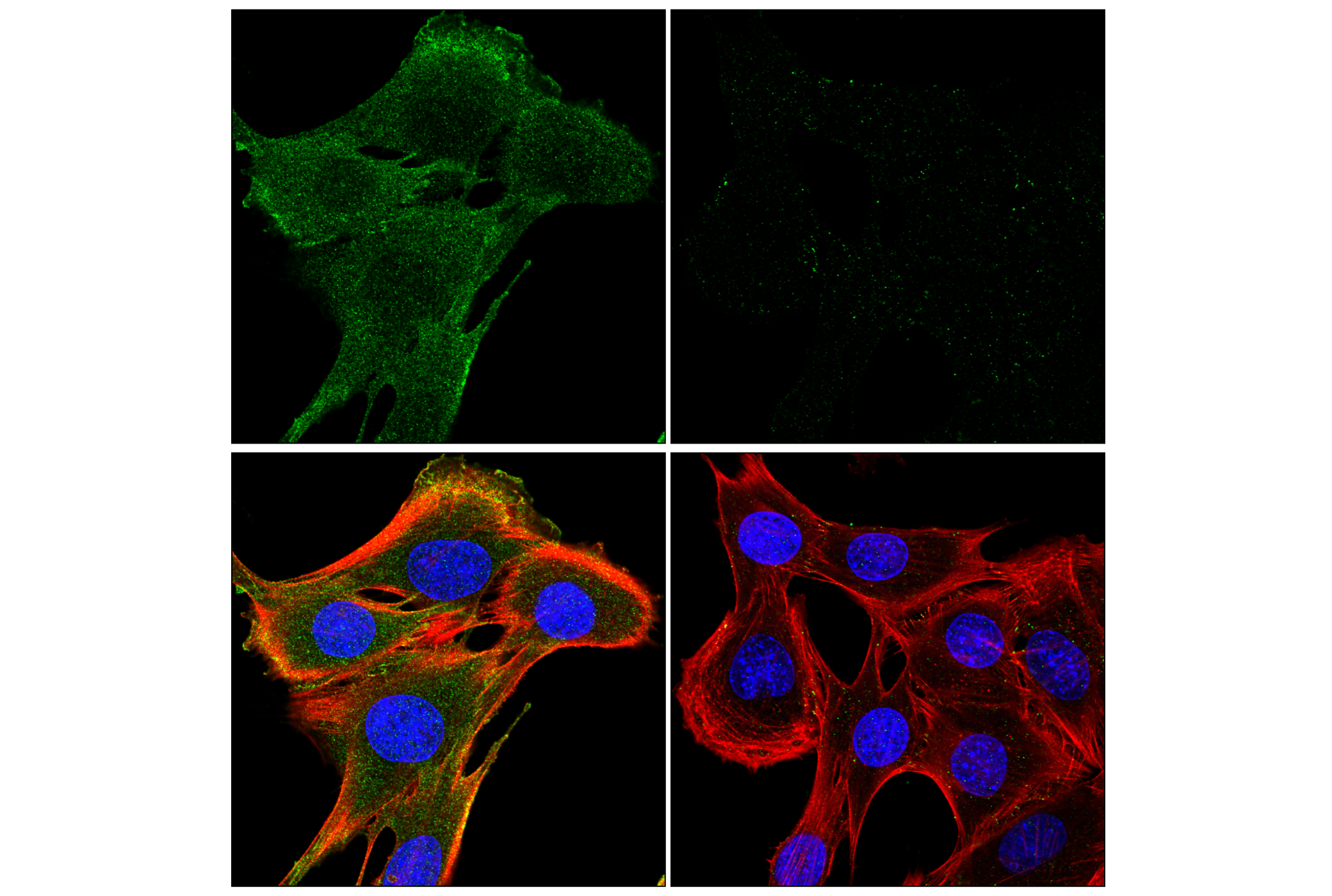 Immunofluorescence Image 1: Phospho-Akt (Ser473) (E4U3U) Mouse mAb