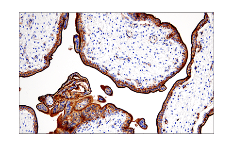  Image 36: Pancreatic Marker IHC Antibody Sampler Kit