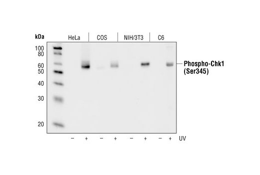  Image 5: Phospho-Chk1/2 Antibody Sampler Kit