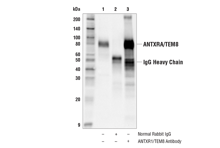 Immunoprecipitation Image 1: ANTXR1/TEM8 Antibody