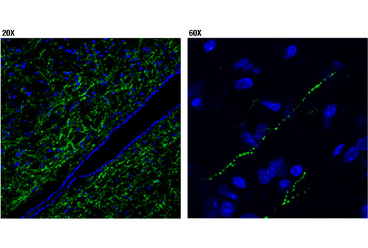 Immunofluorescence Image 1: POMC (D3R1U) Rabbit mAb