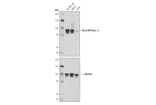 Western Blotting Image 1: Na,K-ATPase α1 (D4Y7E) Rabbit mAb