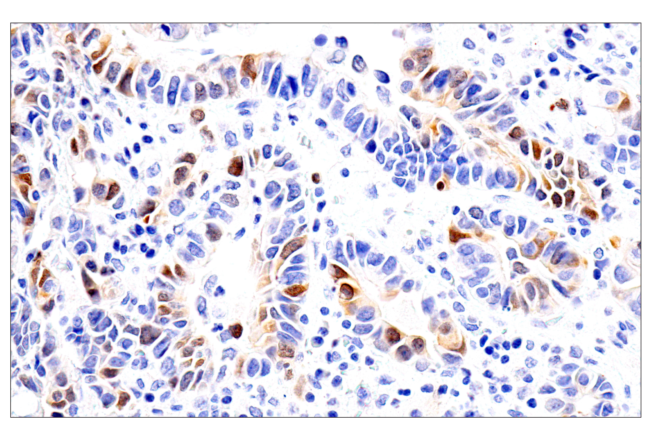  Image 11: PhosphoPlus® Chk1 (Ser317) Antibody Duet
