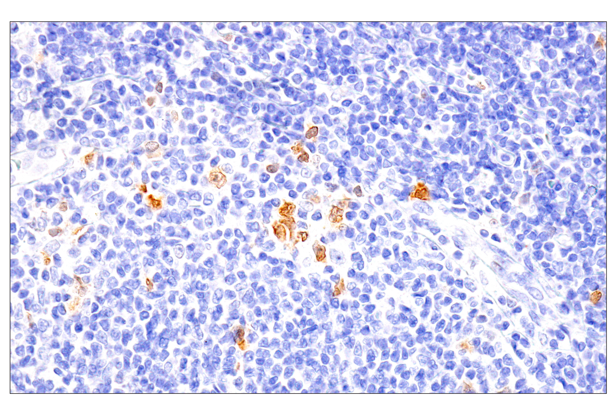 Immunohistochemistry Image 5: Chk1 (2G1D5) Mouse mAb