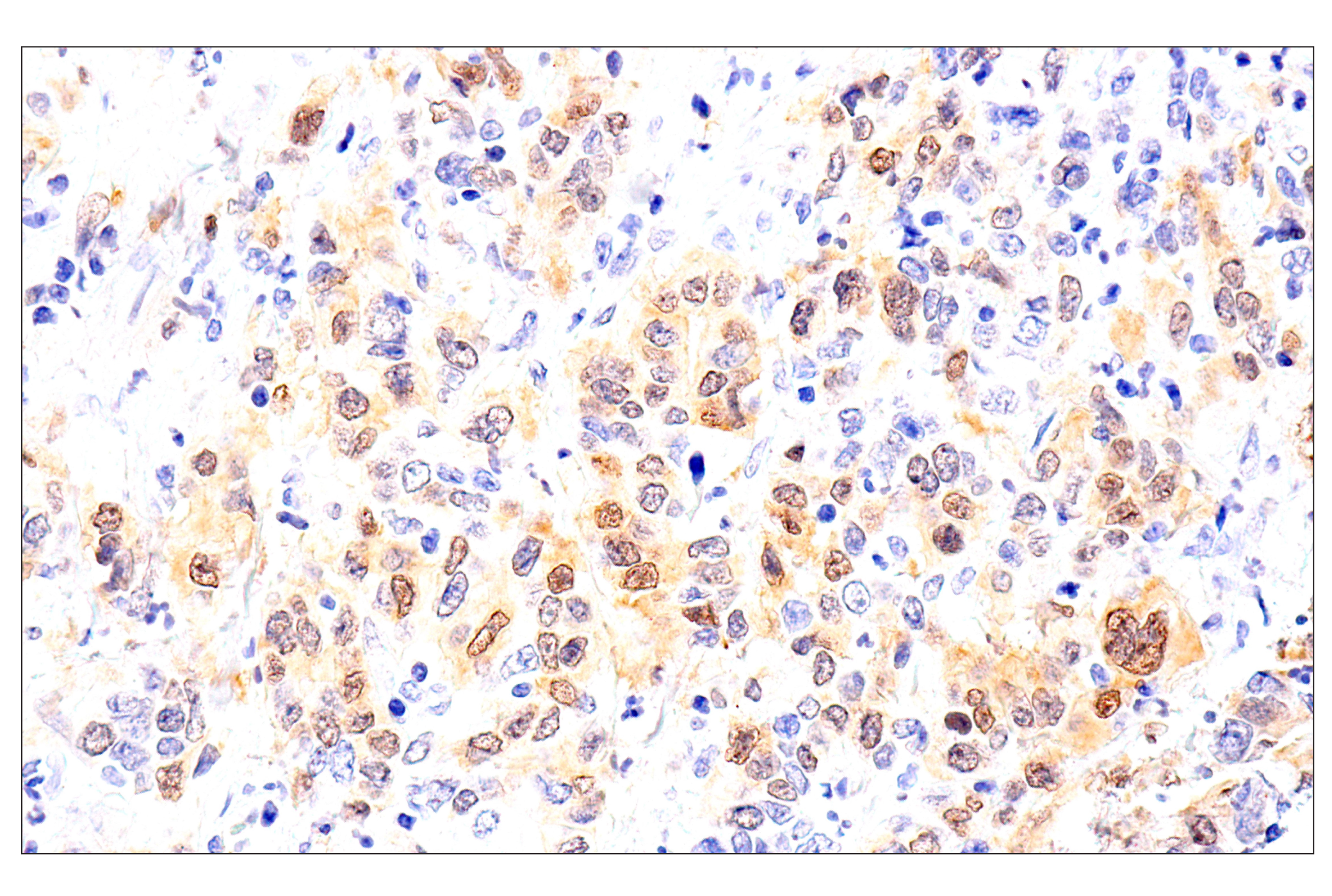 Immunohistochemistry Image 7: Chk1 (2G1D5) Mouse mAb