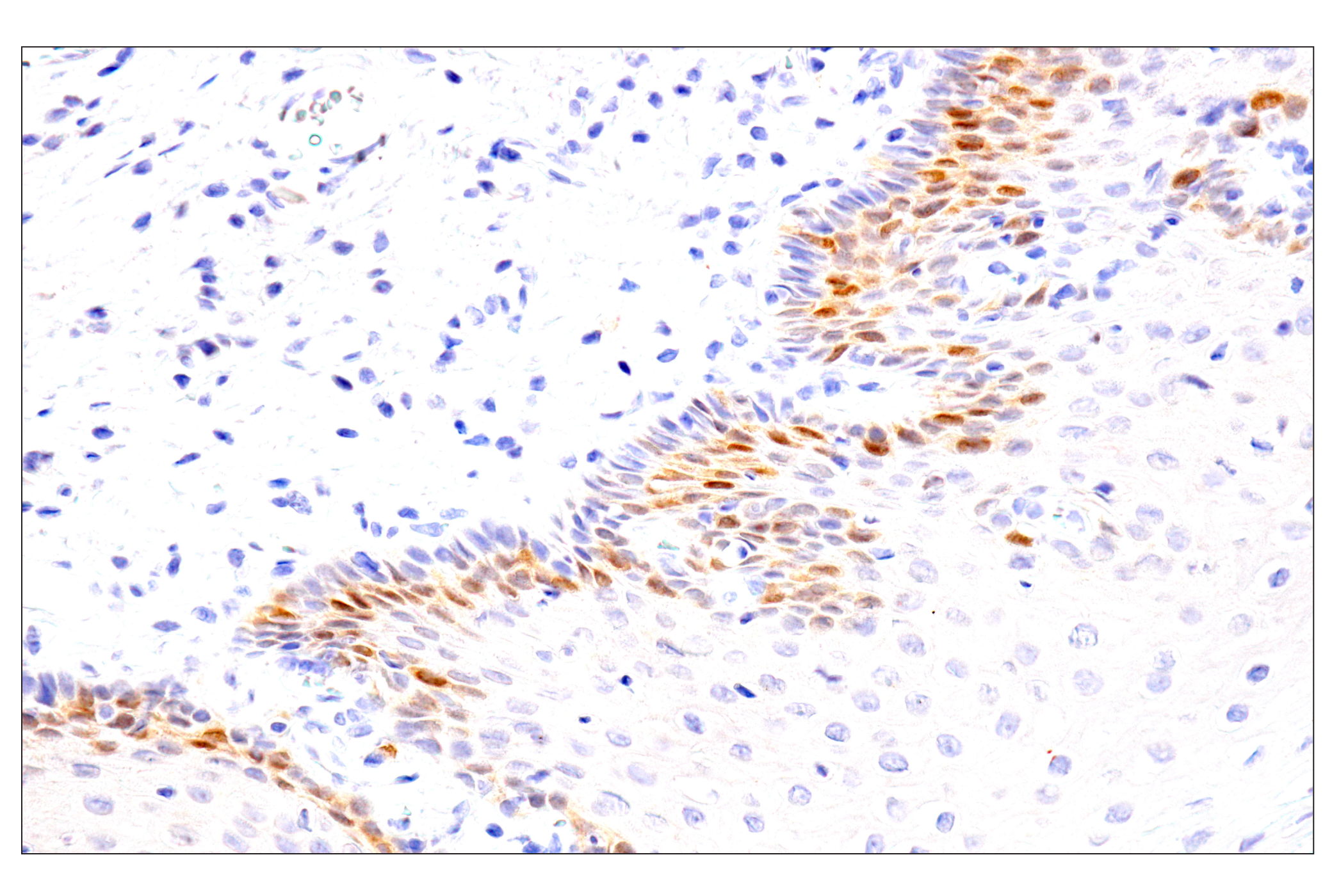  Image 17: PhosphoPlus® Chk1 (Ser317) Antibody Duet