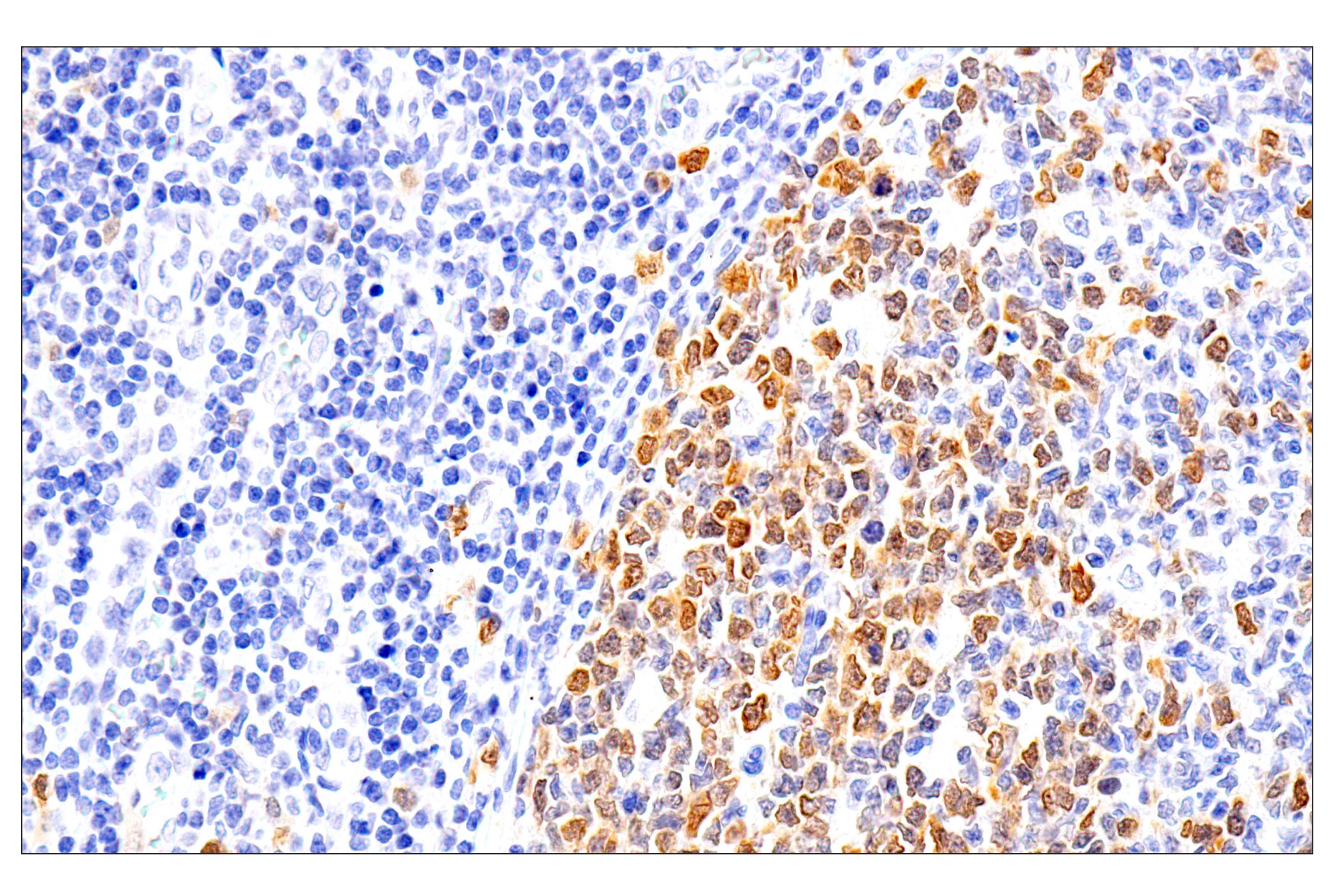 Immunohistochemistry Image 10: Chk1 (2G1D5) Mouse mAb