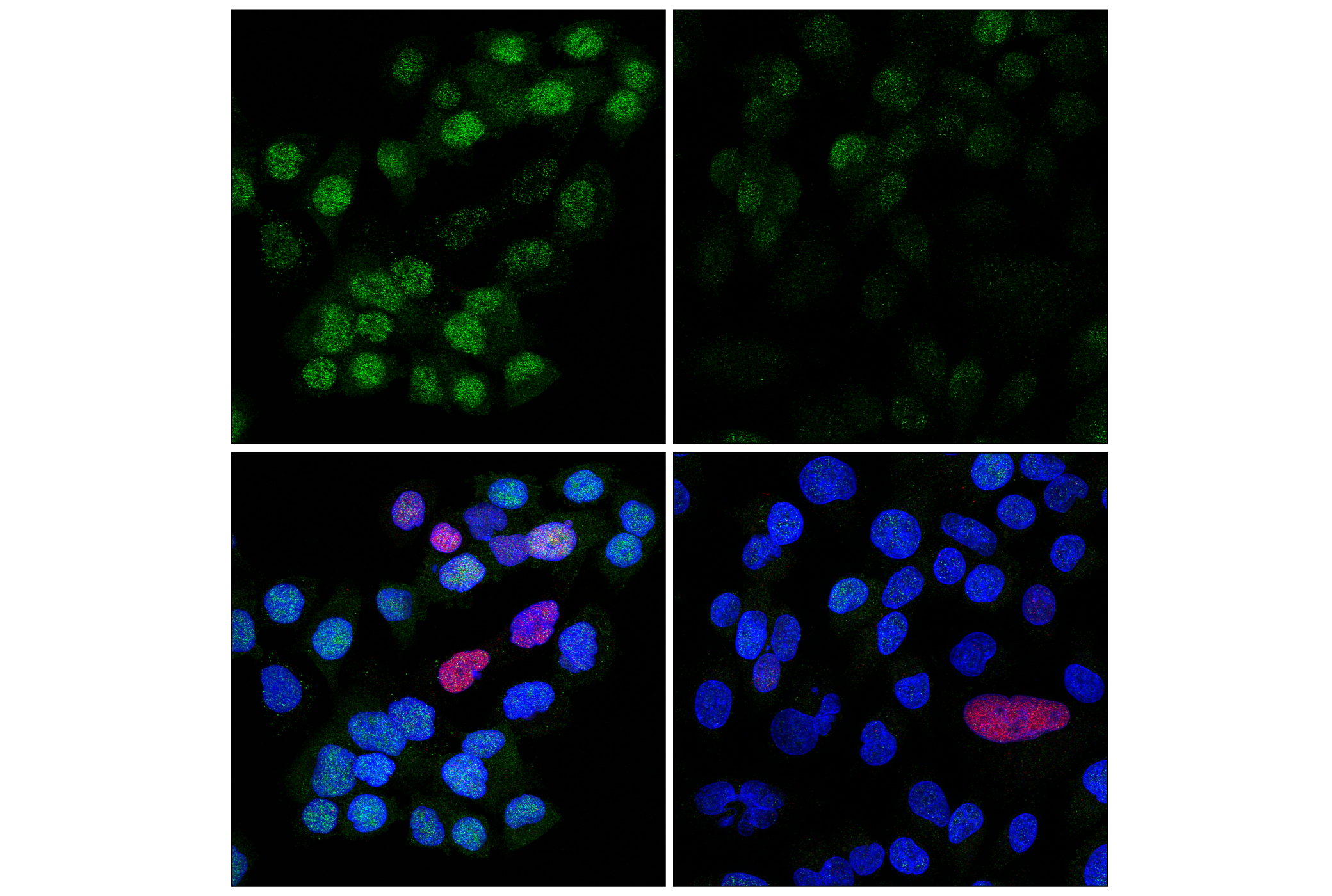 Immunofluorescence Image 1: Chk1 (2G1D5) Mouse mAb