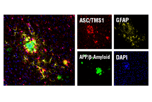 Immunofluorescence Image 1: ASC/TMS1 (D2W8U) Rabbit mAb (Mouse Specific) (Alexa Fluor® 647 Conjugate)