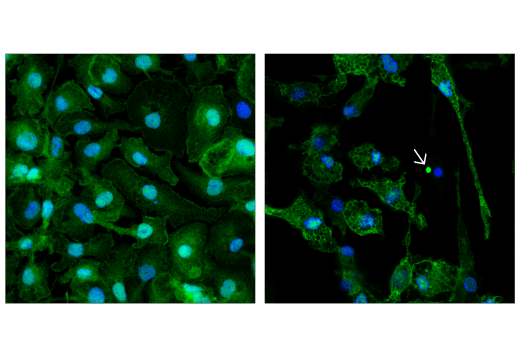 Immunofluorescence Image 2: ASC/TMS1 (D2W8U) Rabbit mAb (Mouse Specific) (Alexa Fluor® 647 Conjugate)