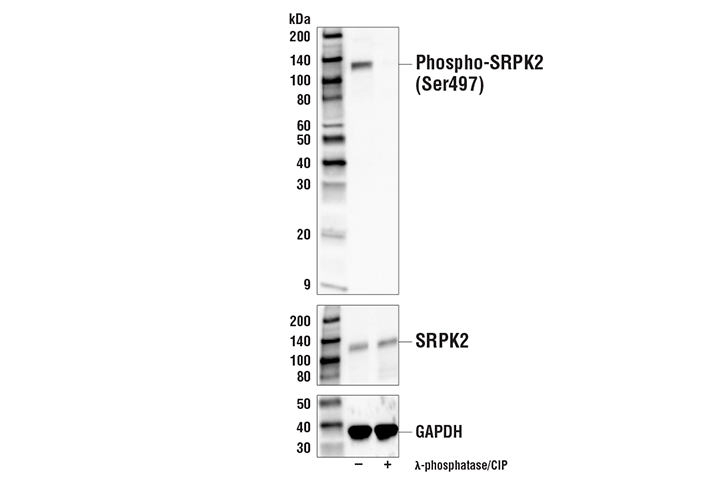 Western Blotting Image 1: Phospho-SRPK2 (Ser497) Antibody