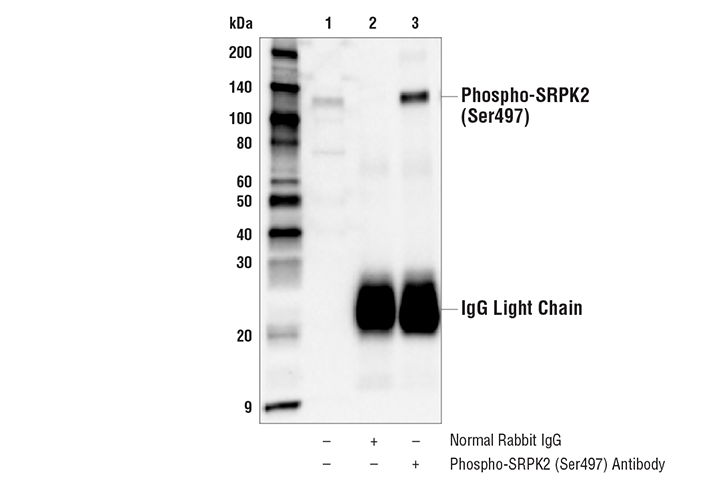Immunoprecipitation Image 1: Phospho-SRPK2 (Ser497) Antibody