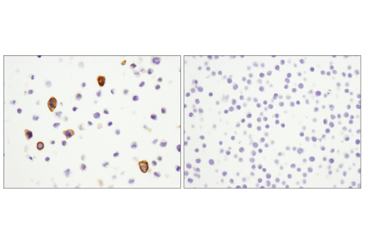 Immunohistochemistry Image 4: CD11b/ITGAM (D6X1N) Rabbit mAb (BSA and Azide Free)