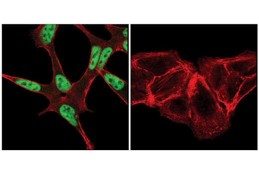 Immunofluorescence Image 1: Androgen Receptor (D6F11) XP® Rabbit mAb (BSA and Azide Free)
