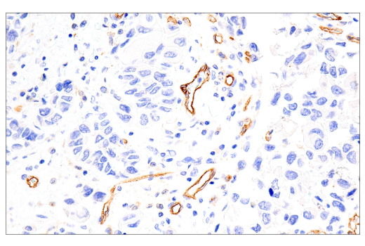 Immunohistochemistry Image 3: IL3RA/CD123 (BR4MS) Mouse mAb