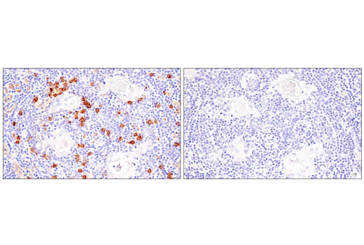 Immunohistochemistry Image 10: IL3RA/CD123 (BR4MS) Mouse mAb