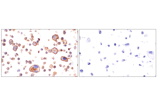 Immunohistochemistry Image 11: IL3RA/CD123 (BR4MS) Mouse mAb
