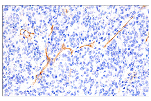 Immunohistochemistry Image 4: IL3RA/CD123 (BR4MS) Mouse mAb